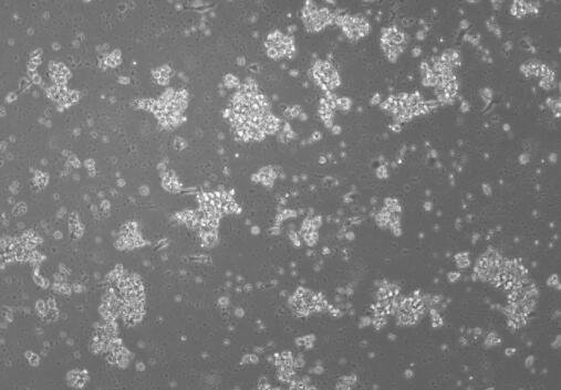 大鼠外周血树突状细胞(成熟DC细胞)