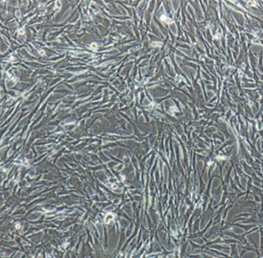 大鼠主动脉外膜成纤维细胞