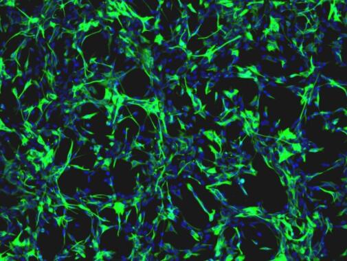 大鼠三叉神经星形胶质细胞
