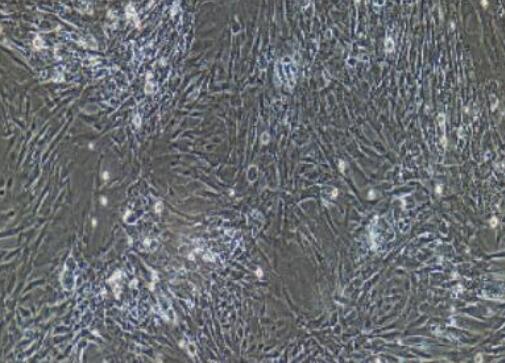 兔椎间盘髓核细胞