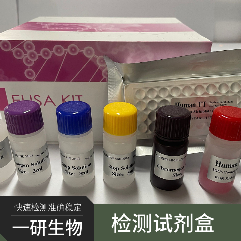 禽传染性支气管炎病毒(AIBV)核酸检测试剂盒