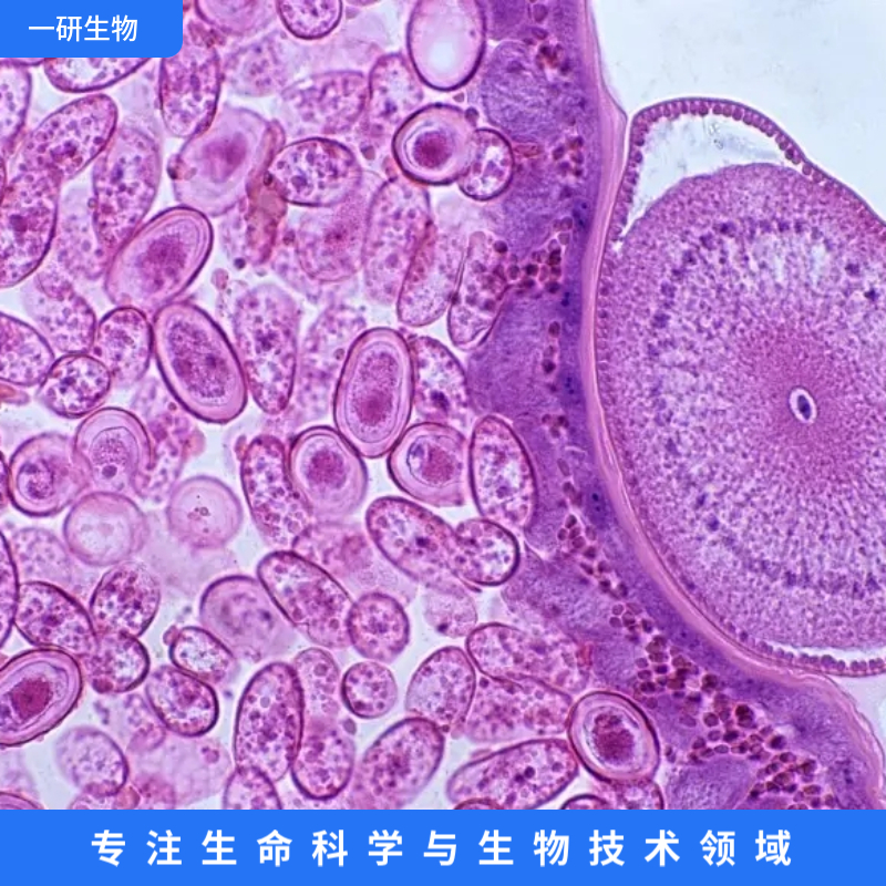 过表达CADM1的骨肉瘤细胞株