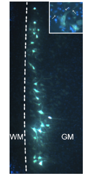 荧光金荧光金(FluoroGold)广泛、有效的神经元逆行示踪剂