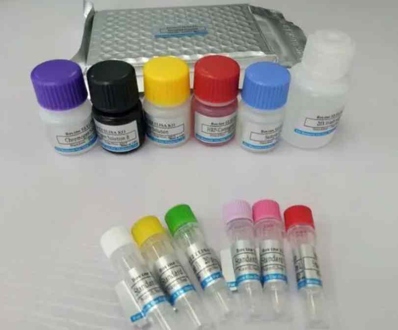 小鼠酪氨酸羟化酶（TH）Elisa试剂盒
