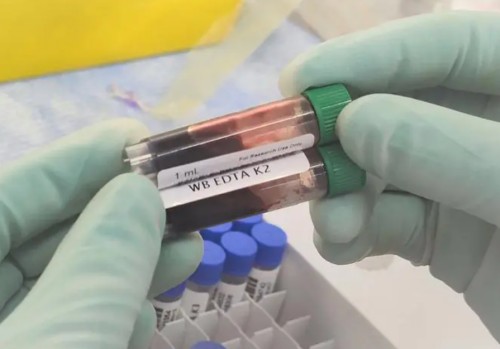 TNFReceptorII Antibody 生产供应商艾普蒂生物