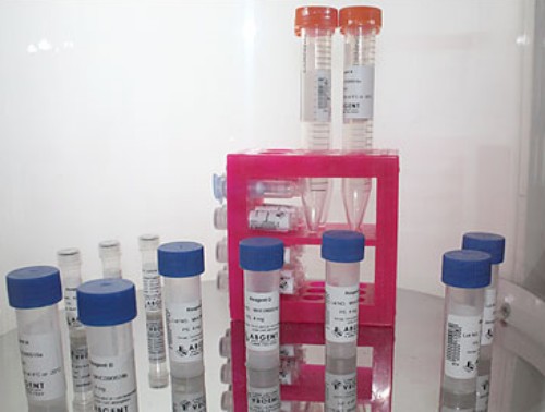 PICK1 Antibody 生产供应商艾普蒂生物