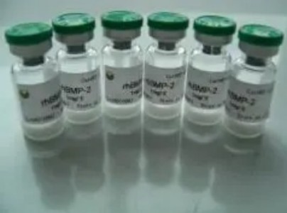 重组 人UCH37/UCHL5 蛋白 生产供应商 艾普蒂生物