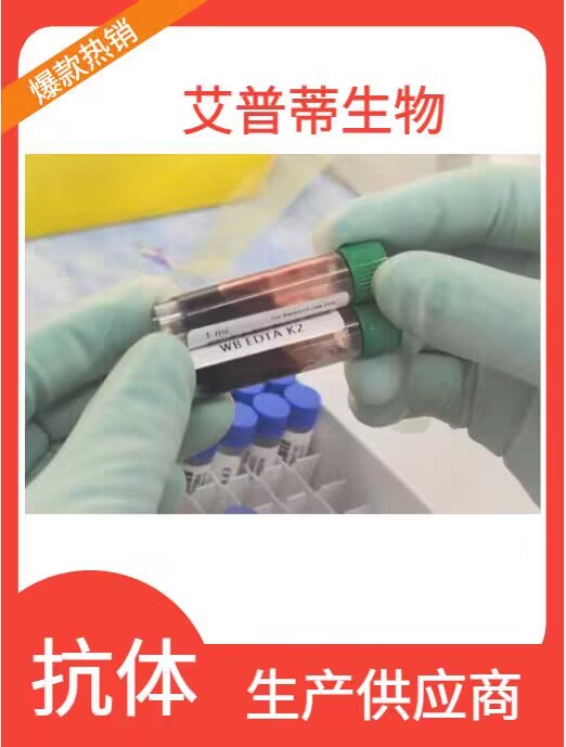 小鼠血管生成素样蛋白7(ANGPTL7)重组蛋白 生产供应商 艾普蒂生物