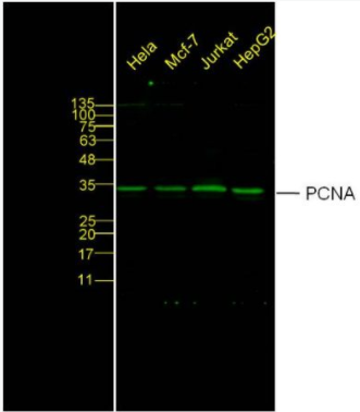 Anti-PCNA-增殖细胞核抗原抗体