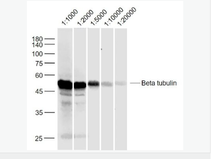 微管蛋白β tubulin/Tubulin β（内参）抗体