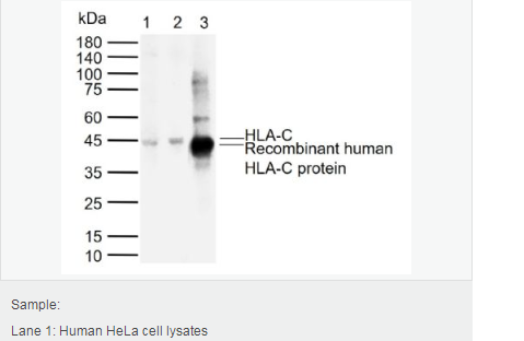 Anti-HLA-C antibody-组织相容性蛋白1单克隆抗体
