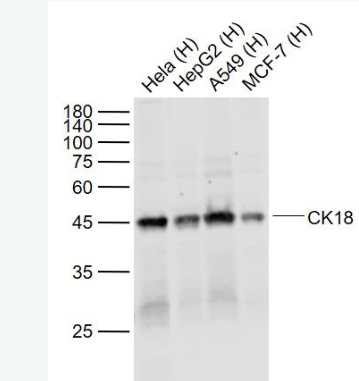 Anti-CK18 antibody-细胞角蛋白18单克隆抗体