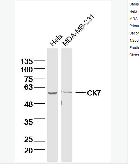 Anti-CK7 antibody-细胞角蛋白7单克隆抗体