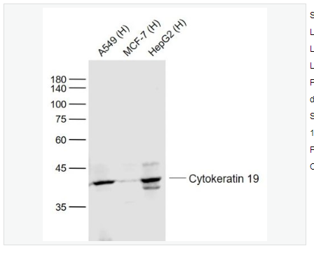 Anti-Cytokeratin 19 antibody-细胞角蛋白19单克隆抗体