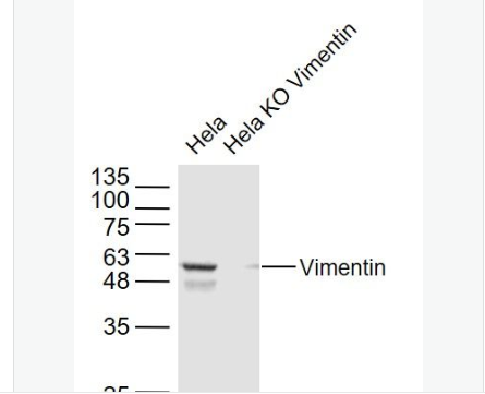 Anti-Vimentin antibody-波形蛋白抗体