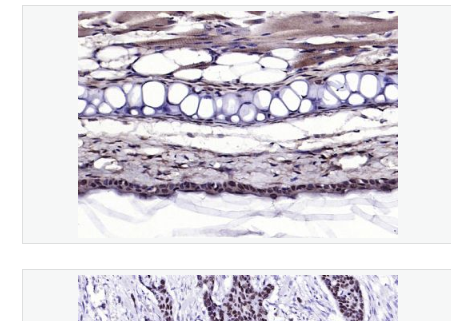 Anti-human P53 antibody-肿瘤抑制基因P53蛋白抗体