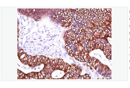 Anti-Cytokeratin 8 antibody-细胞角蛋白8单克隆抗体