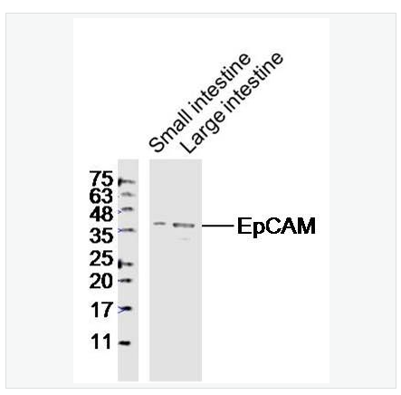 Anti-EpCAM antibody-上皮细胞粘附分子（CD326）抗体