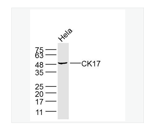 Anti-CK17 antibody-细胞角蛋白17单克隆抗体