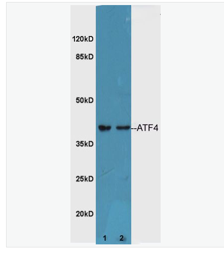 Anti-ATF4 antibody-活化转录因子4抗体