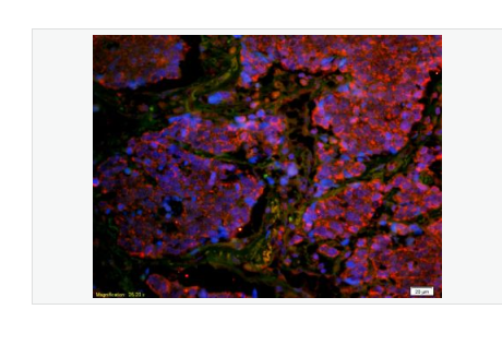 Anti-CD8B antibody-CD8β链（CD8-β）抗体