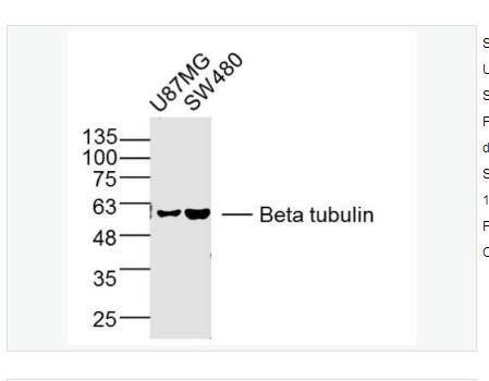 Anti-Beta tubulin-微管蛋白β tubulin/Tubulin β（内参）单克隆抗体