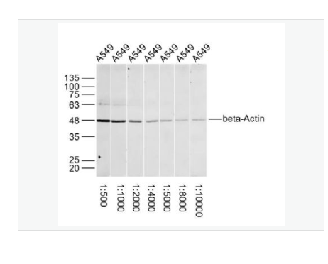 Anti-beta-Actin -β-肌动蛋白/β-Actin（内参）抗体