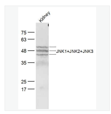 Anti-JNK1+JNK2+JNK3 antibody-氨基末端激酶1/2/3抗体