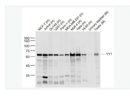 Anti-YY1 -核转录调节因子YY1 （核内参）重组兔单克隆抗体