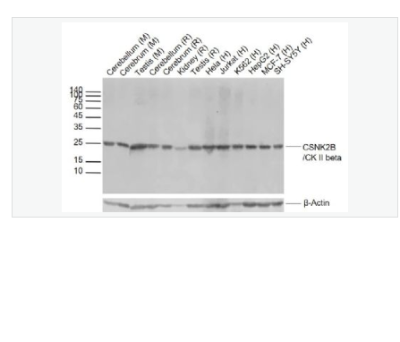 Anti-CSNK2B-丝/苏氨酸蛋白激酶II β重组兔单克隆抗体