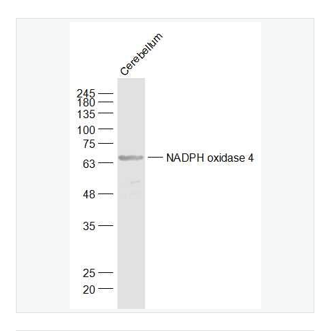 Anti-NADPH oxidase 4 antibody-NADPH氧化酶4抗体