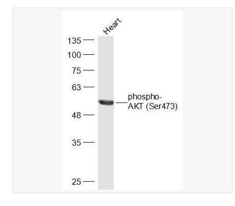 Anti-phospho-AKT-磷酸化蛋白激酶B抗体