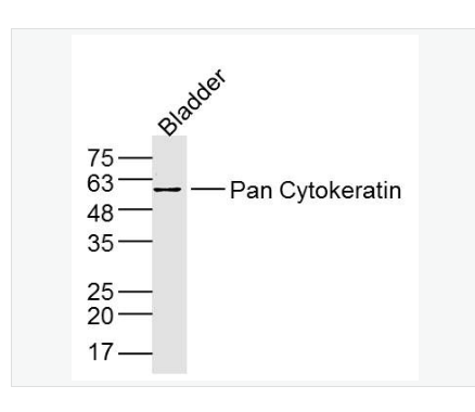 Anti-Pan Cytokeratin antibody-广谱细胞角蛋白PCK抗体