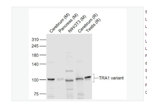 Anti-TRA1 variant antibody -肿瘤排斥抗原gp96 1 变异体抗体