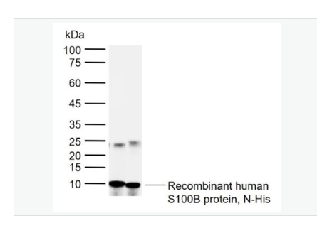 Anti-S100B antibody -人S100B蛋白多克隆抗体