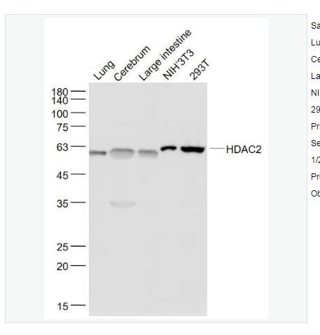 Anti-HDAC2 antibody -组蛋白去乙酰化酶2重组兔单克隆抗体
