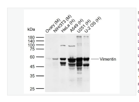 Anti-Vimentin antibody  -波形蛋白抗体