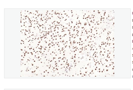 Anti-phospho-SMAD5   -磷酸化细胞信号转导分子SMAD5重组兔单克隆抗体