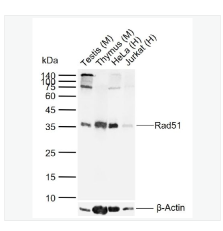 Anti-Rad51 antibody  -Rad51重组兔单克隆抗体