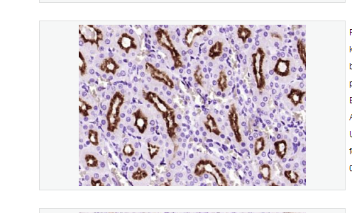 Anti-Klotho antibody-Klotho多肽蛋白抗体