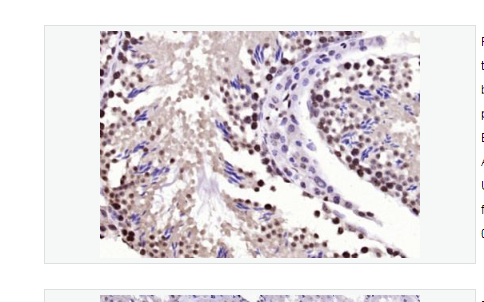 Anti-BPTF antibody -胎儿阿兹海默病抗原/核小体重塑因子抗体