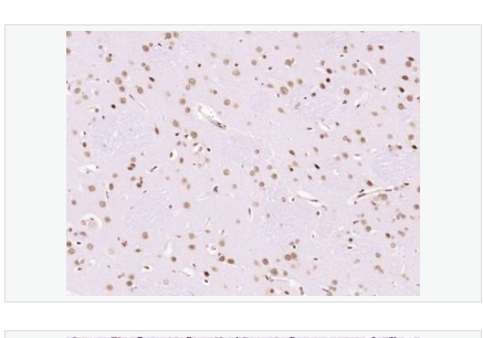 Anti-LMX1b antibody -指甲髌骨综合征相关蛋白NPS1抗体