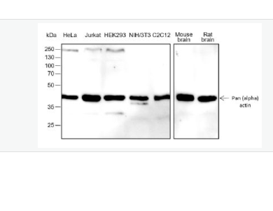 Anti-Pan Actin antibody-泛肌动蛋白重组兔单抗