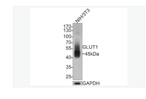 Anti-GLUT1 antibody-葡萄糖转运蛋白1重组兔单克隆抗体