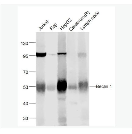 Anti-Beclin 1 antibody-自噬效应蛋白Beclin 1单克隆抗体