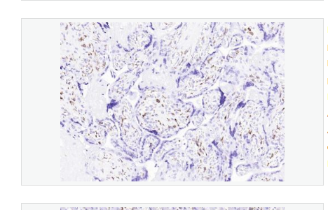 Anti-CD163 antibody -CD163重组兔单克隆抗体