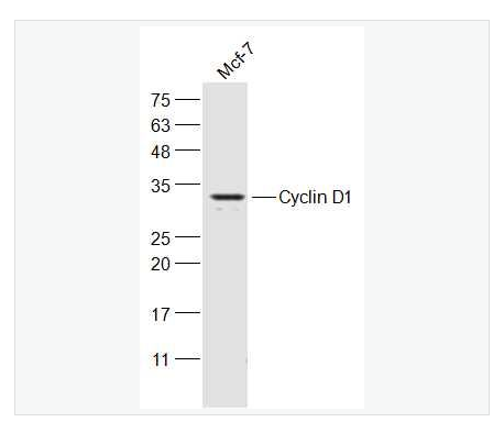 Anti-Cyclin D1 antibody -周期素D1抗体