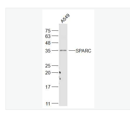 Anti-SPARC antibody -富含半胱氨酸的酸性分泌蛋白抗体