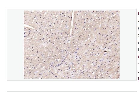 Anti-phospho-AMPK alpha-2  -磷酸化腺苷单磷酸活化蛋白激酶α2抗体