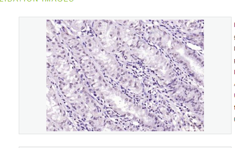 Anti-SIK1 antibody  -丝氨酸/苏氨酸蛋白激酶SIK1抗体